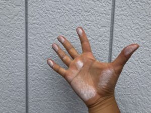 手に付いた白いチョーキング・外壁の劣化現象